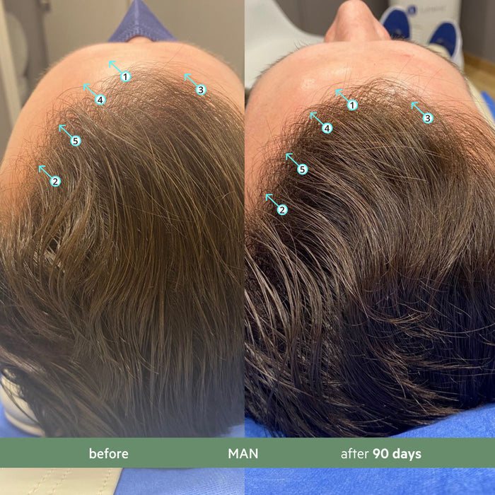 Revita.CBD Kit | Hair DENSITY Shampoo w/ CBD & Conditioner