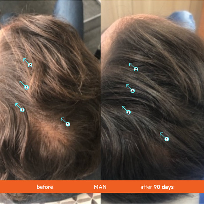 Men's Hair Density Kit | Revita Shampoo/Conditioner + Men's