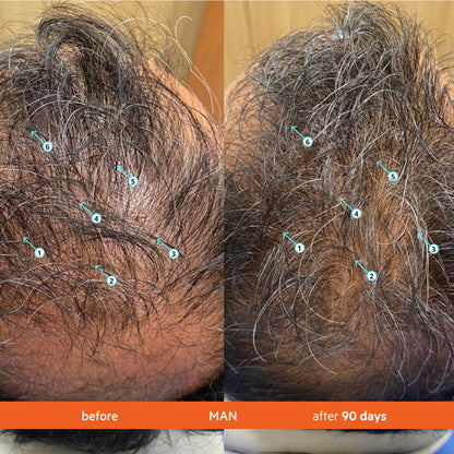 Men's Hair Density Kit | Revita Shampoo/Conditioner + Men's